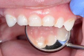 Image illustrating examination of anterior teeth