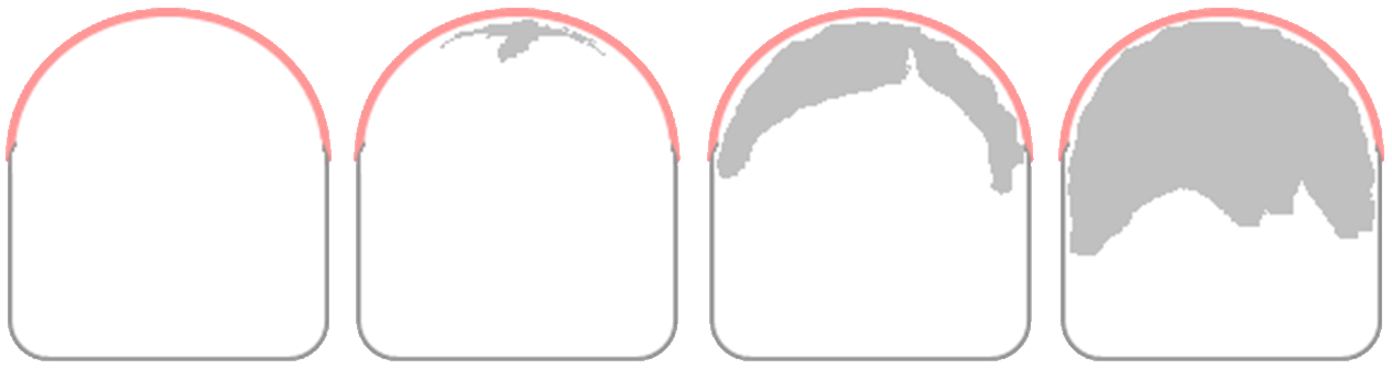 Diagrams of teeth with plaque