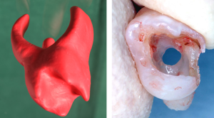 Model showing pulp morphology and photograph of perforated pulp chamber floor