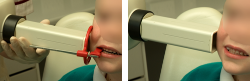 Images showing a child having radiographs taken